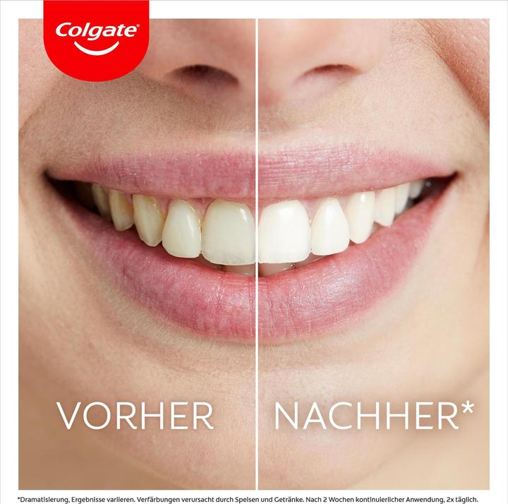 Actual product image Colgate Max White Ultim Whitening Kit (Bleaching LED light)