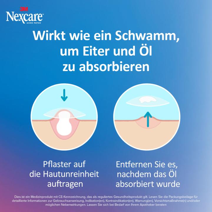 Produktbild - Akne-Pflaster (15x)