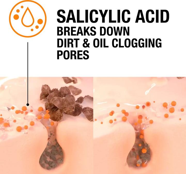 Actual product image Neutrogena Visibly Clear (50 ml)