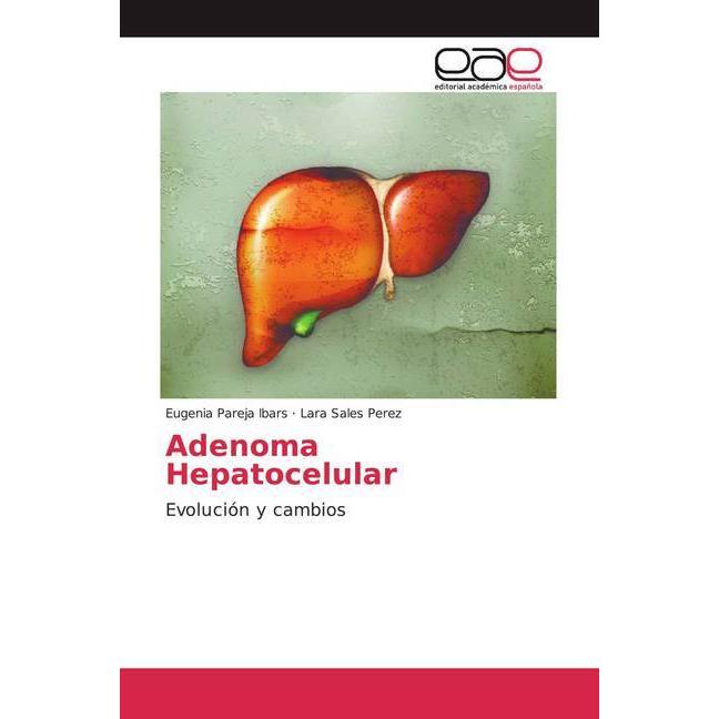 Adenoma Hepatocelular, Fachbücher von Lara Sales Perez, Eugenia Pareja Ibars