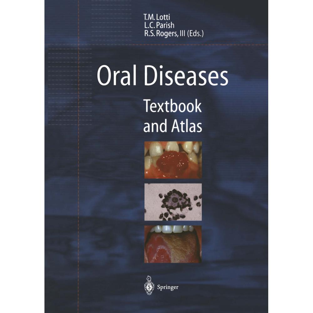 Oral Diseases, Fachbücher von Lawrence C. Parish, Roy S.III Rogers, Torello M. Lotti
