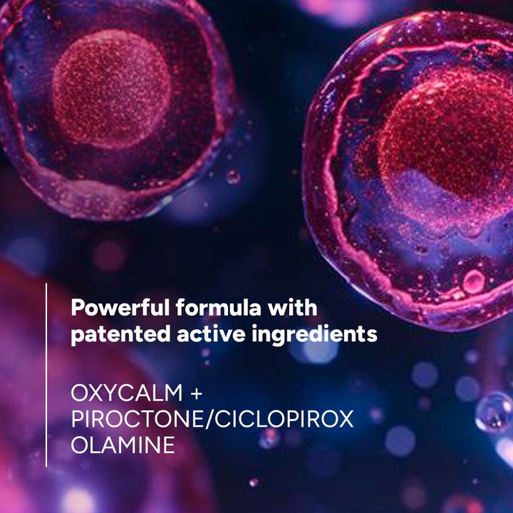 Actual product image Ducray KELUAL DS INTENSIVE Shampoo (Liquid shampoo, 100 ml)