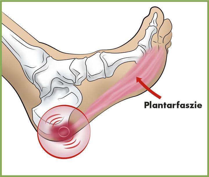 Actual product image Deeelbasics Faszien-Fussroller