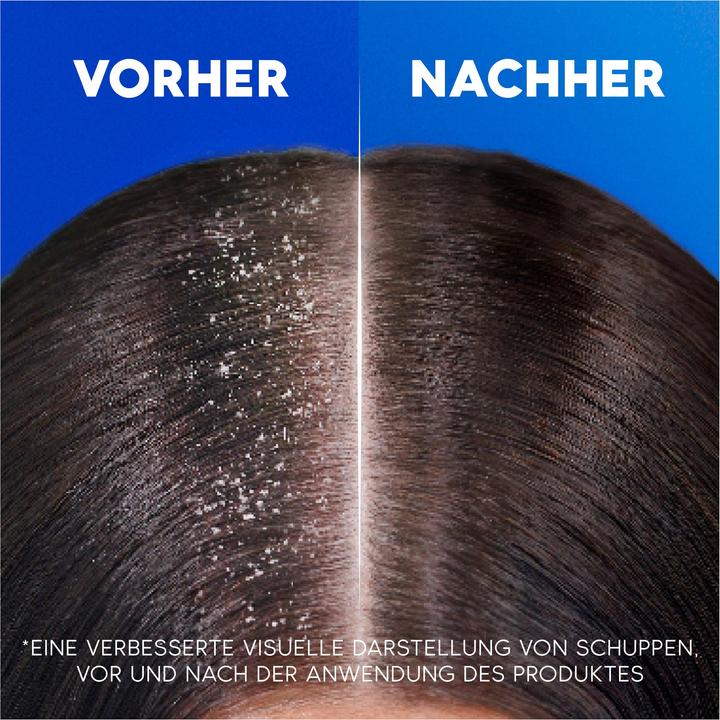 Image du produit Head & Shoulders Apple Fresh (200 ml, Shampoing liquide)