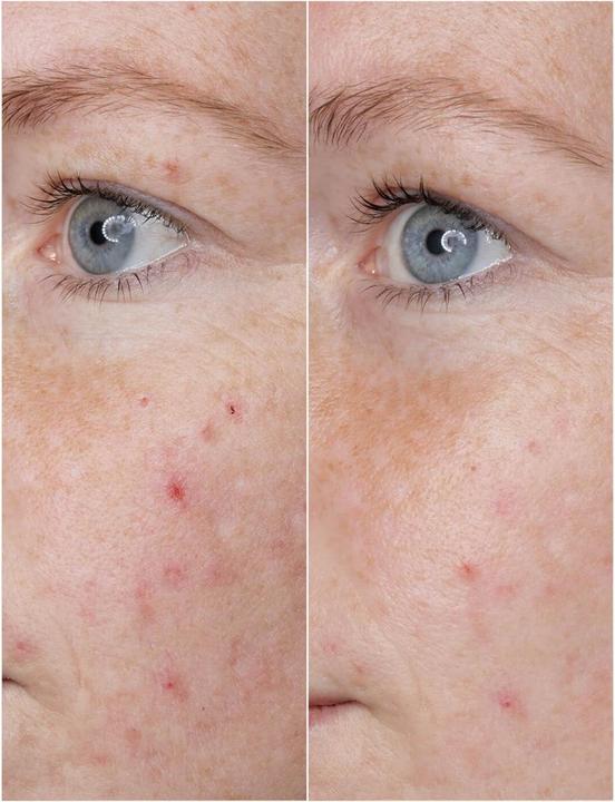 Produktbild Babor Power Serum Ampoules Hyaluronic Acid 3 x 2 ml (6 ml)