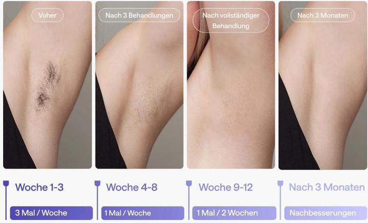 Image du produit Ulike Air 3 PUR