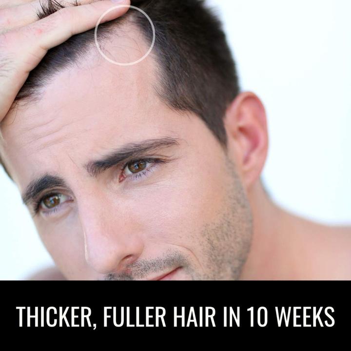 Produktbild Beneva Black Anti-Haarausfall Box (150 ml)