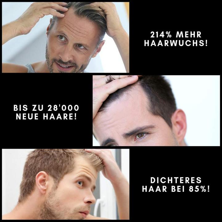 Produktbild Beneva Black Anti-Haarausfall Box (150 ml)