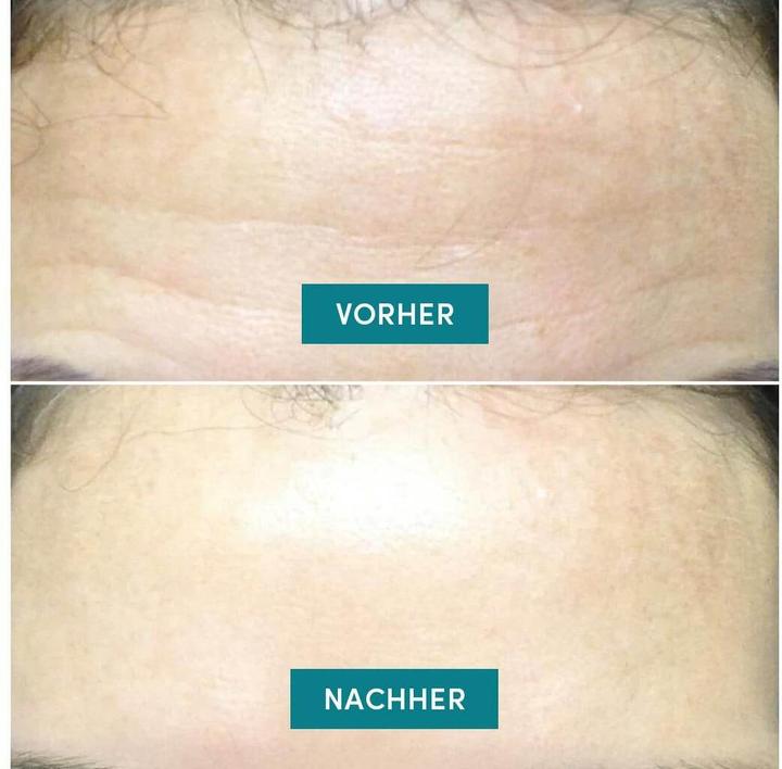 Produktbild Apricot Anti-Aging-Pad