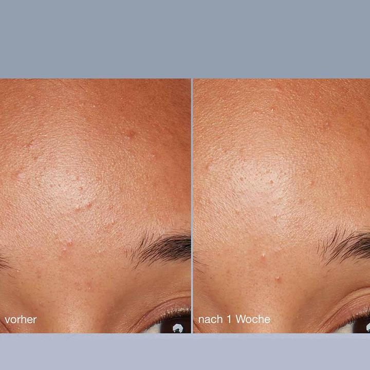 Actual product image Dermalogica Daily Microfoliant (Cleansing scrub, 75 ml)