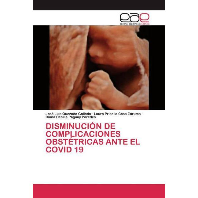 Disminución De Complicaciones Obstétricas Ante El Covid 19, Fachbücher von Diana Cecilia Paguay Paredes, José Luis Queza...