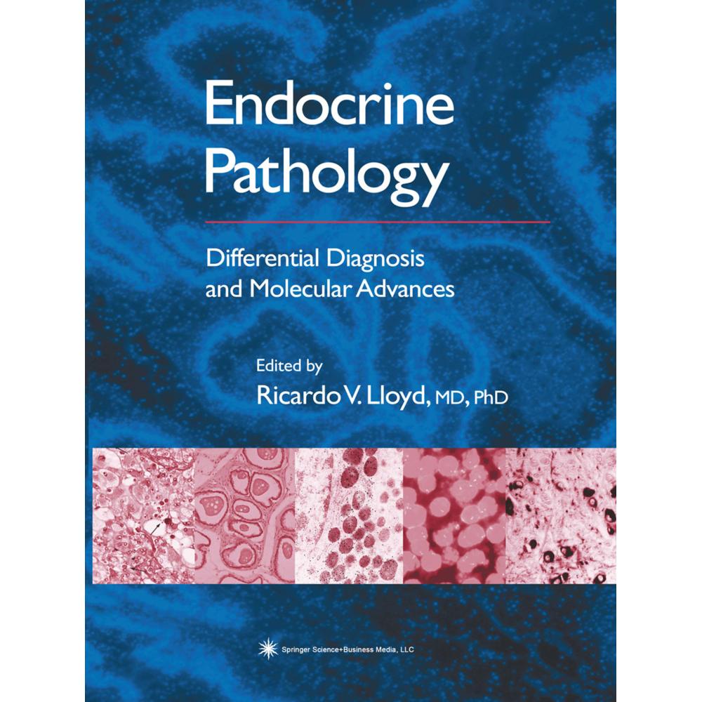Endocrine Pathology, Fachbücher von Ricardo V. Lloyd