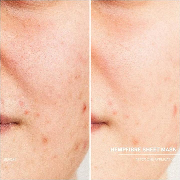 Image du produit Babor DOCTEUR - Masque en fibre de chanvre