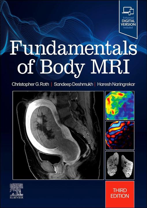 Fundamentals of Body MRI (Englisch, Haresh Naringrekar, Deshmukh Sandeep, Roth Christopher G., 2024)