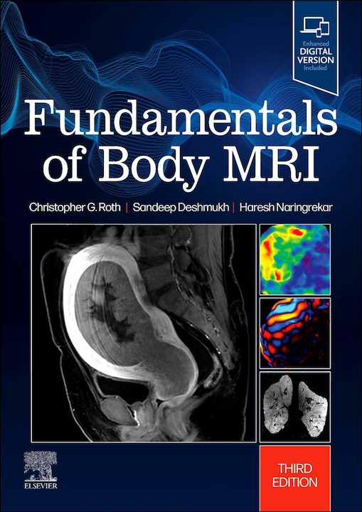 Immagine prodotto Fundamentals of Body MRI (Inglese, Haresh Naringrekar, Deshmukh Sandeep, Roth Christopher G., 2024)