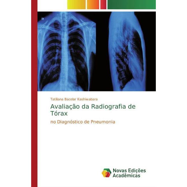 Thumbnail - Avaliação da Radiografia de Tórax, Fachbücher von Tatiliana Bacelar Kashiwabara