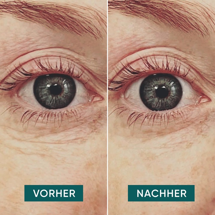 Produktbild Apricot wiederverwendbares Anti-Falten-Augen Pads mit Hyaluron (Patches)