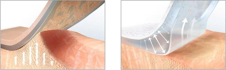 Produktbild Hansaplast Ultra Sensitive XL (5 x)