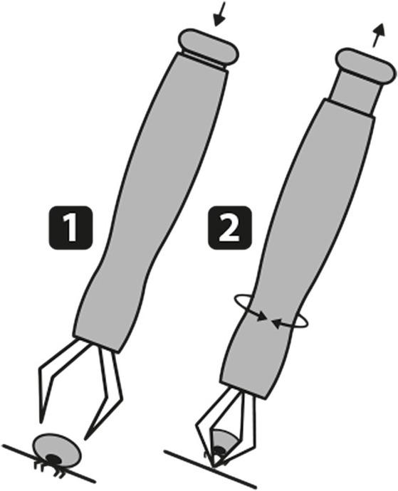 Immagine prodotto Karlie Zeckenzangen (Cane)