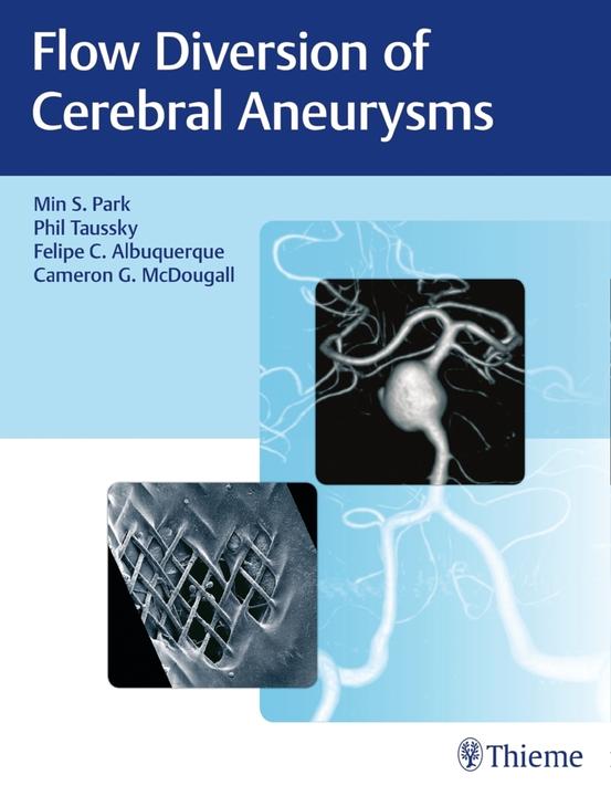 Produktbild Flow Diversion of Cerebral Aneurysms (Englisch, Cameron G. McDougall, Felipe C. Albuquerque, Min S. Park, Philipp Taussky, 2017)