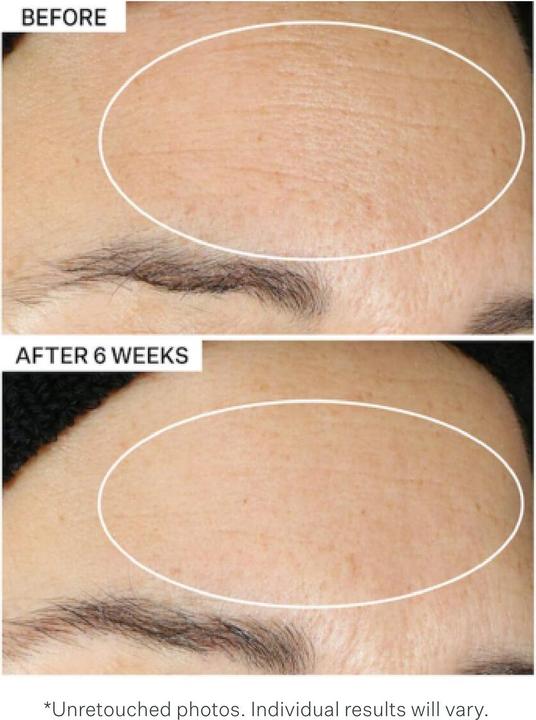 Actual product image StriVectin Super-B Barrier (30 ml)