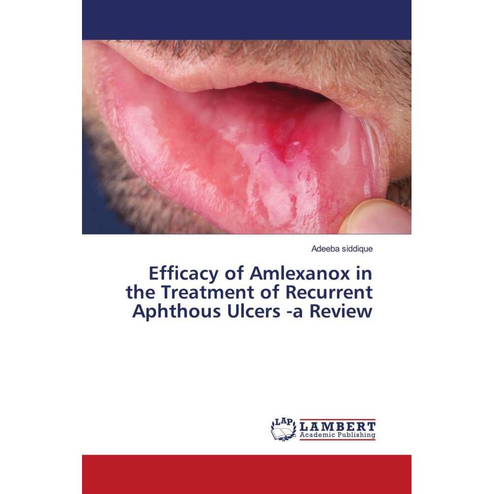 Efficacy of Amlexanox in the Treatment of Recurrent Aphthous Ulcers -a Review, Fachbücher von Adeeba siddique