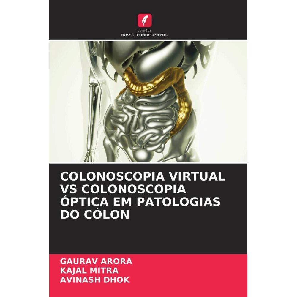 Various Publishers Colonoscopia Virtual Vs Colonoscopia óptica Em Patologias Do Cólon (Deutsch, Avinash Dhok, Gaurav Arora, Kajal Mitra, 2022) (56866417)
