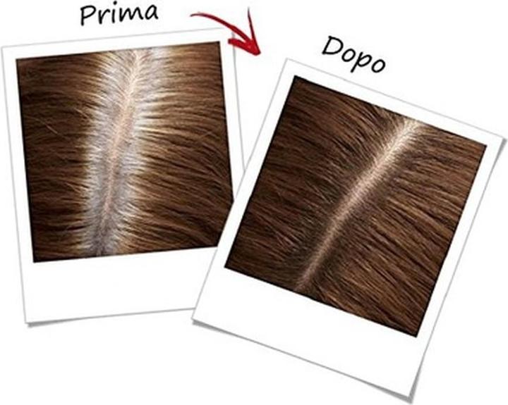 Produktbild L'Oréal Paris L'Oreal Perfect Retouching Spray Root Retouching I Castani 75ml (castano medio)