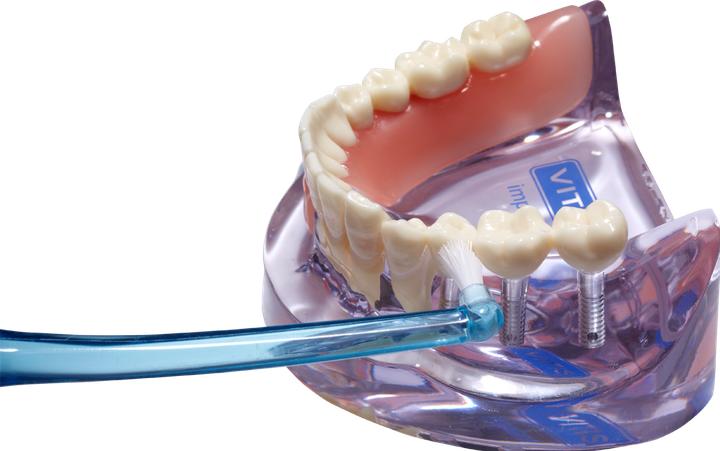 Immagine prodotto Dentaid Impianto Vitis Monotip Zb (1 x)