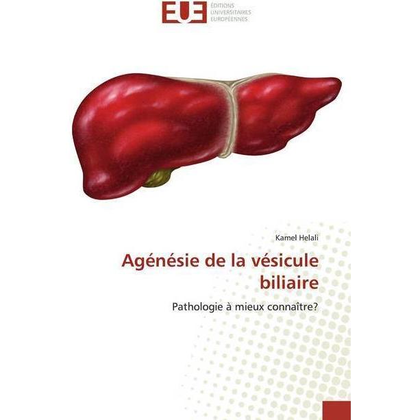 Agénésie de la vésicule biliaire, Fachbücher von Kamel Helali