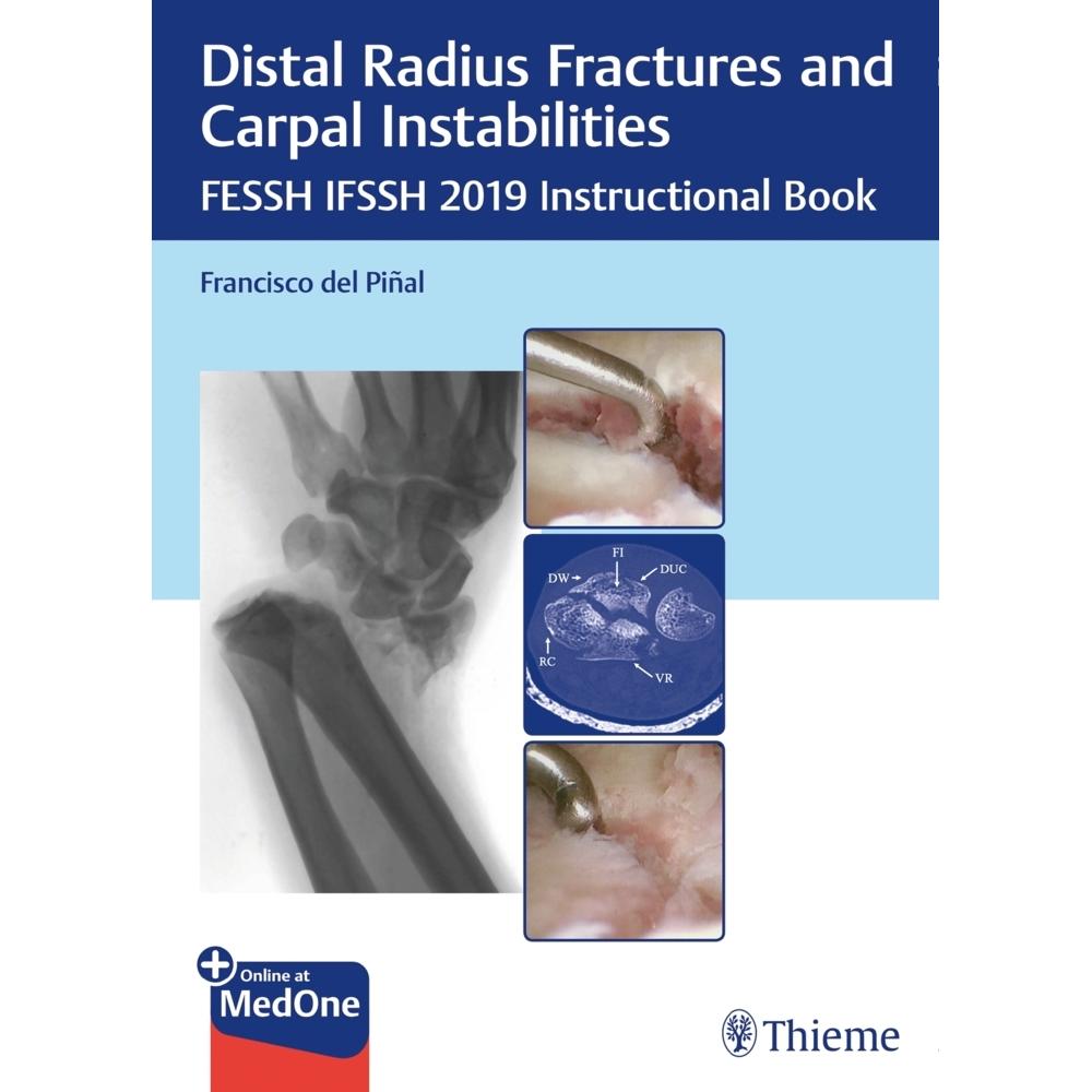 Thieme, Stuttgart, Bandage, Distal Radius Fractures and Carpal Inst