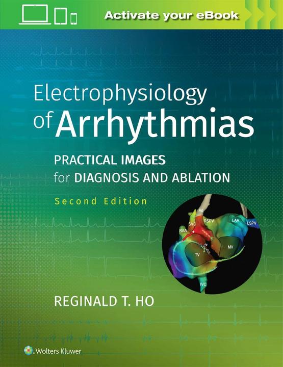 Immagine prodotto Electrophysiology of Arrhythmias (Inglese, Reginald T. Ho, 2019)
