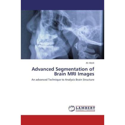 Advanced Segmentation of Brain MRI Images, Fachbücher von Ali Abidi