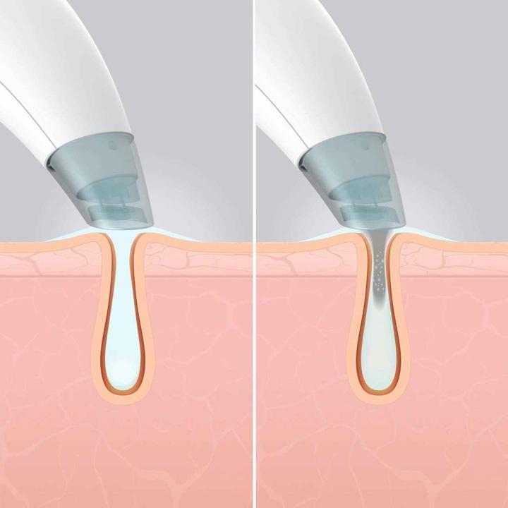 Actual product image Homedics Hydrafacial Cleanser