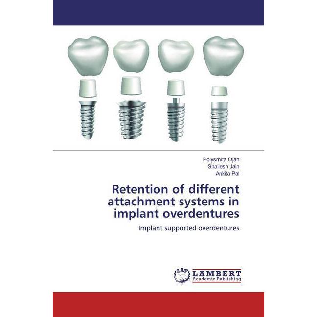 Retention of different attachment systems in implant overdentures, Fachbücher von Polysmita Ojah Shailesh Jain Ankita Pa...