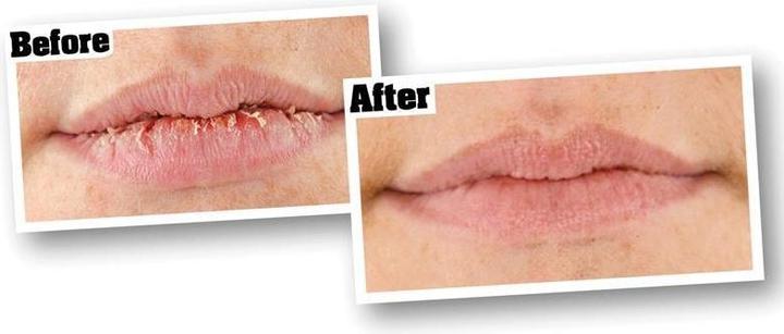 Immagine prodotto O'Keeffe's Lip Repair Lippenbalsam (Balsamo per le labbra)