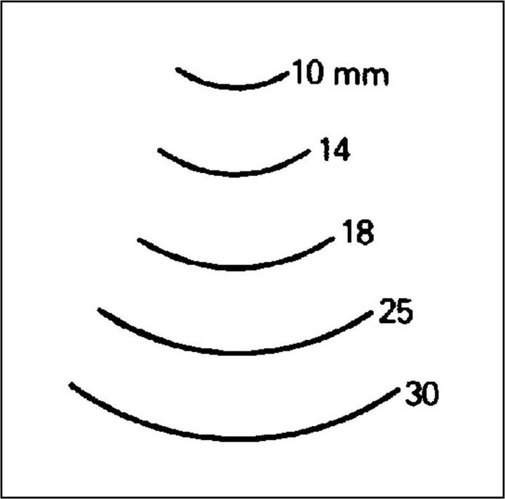 Produktbild Bildhauereisen abgekröpfte Form (14 mm)