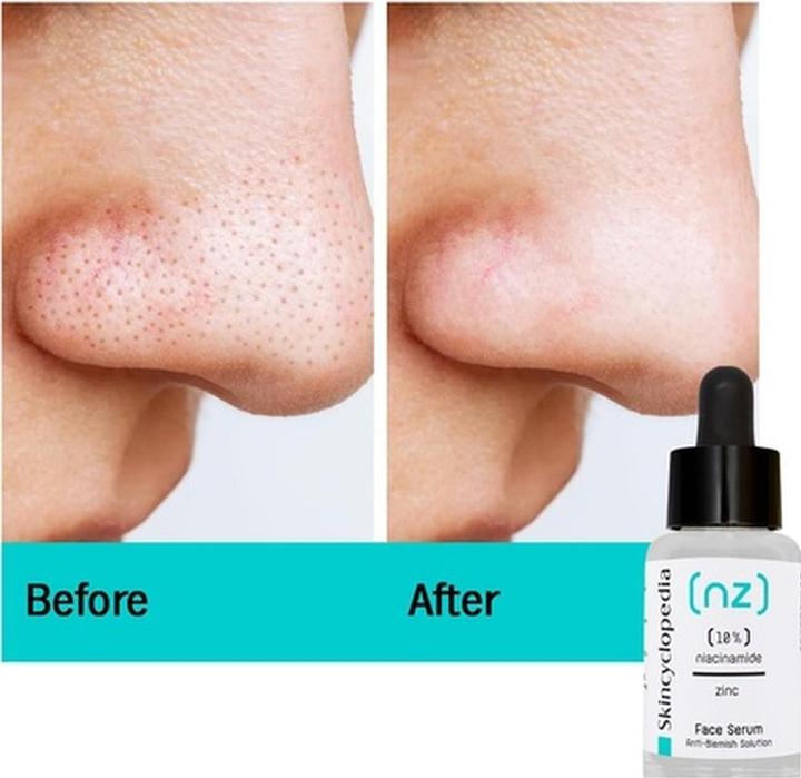 Immagine prodotto Skincyclopedia 10% di niacinamide + 1% di zinco (30 ml)