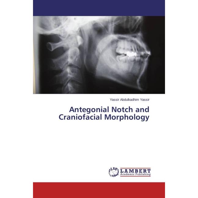 Antegonial Notch and Craniofacial Morphology, Fachbücher von Yassir Abdulkadhim Yassir