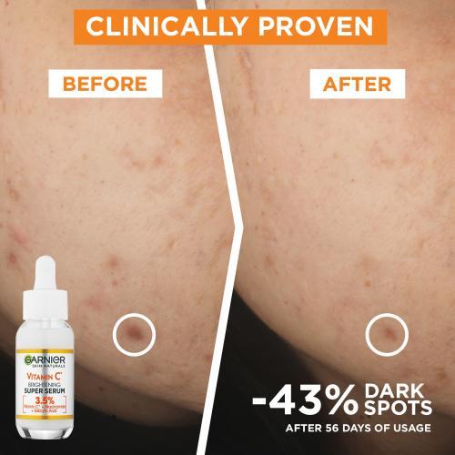 Produktbild Garnier Skin Naturals Vitamin C (30 ml)