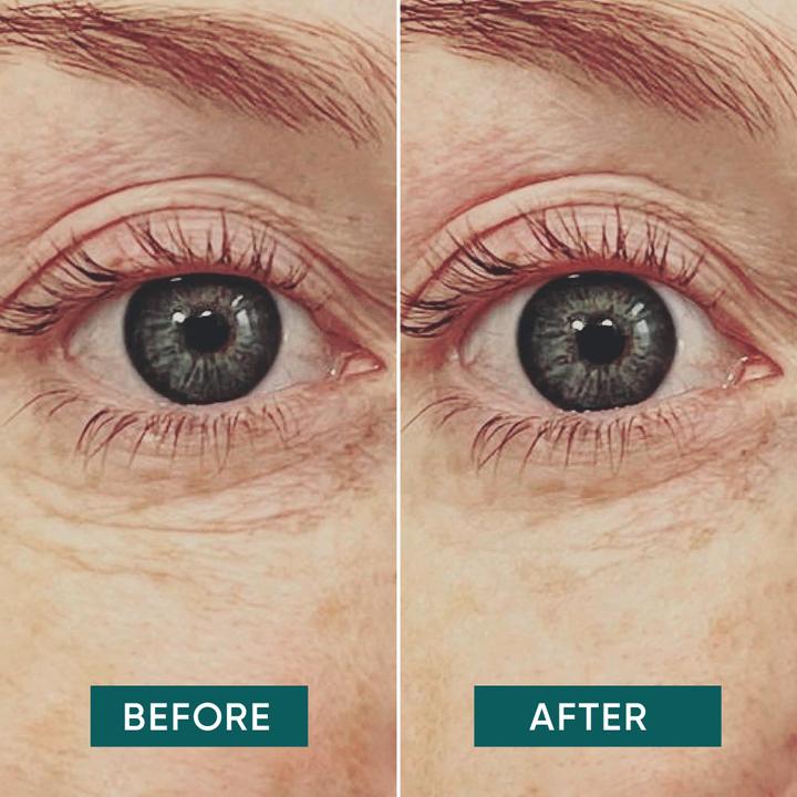 Actual product image Apricot Twice as Nice - Duo "me, myself & eye" Eye Pads (Eye patches)