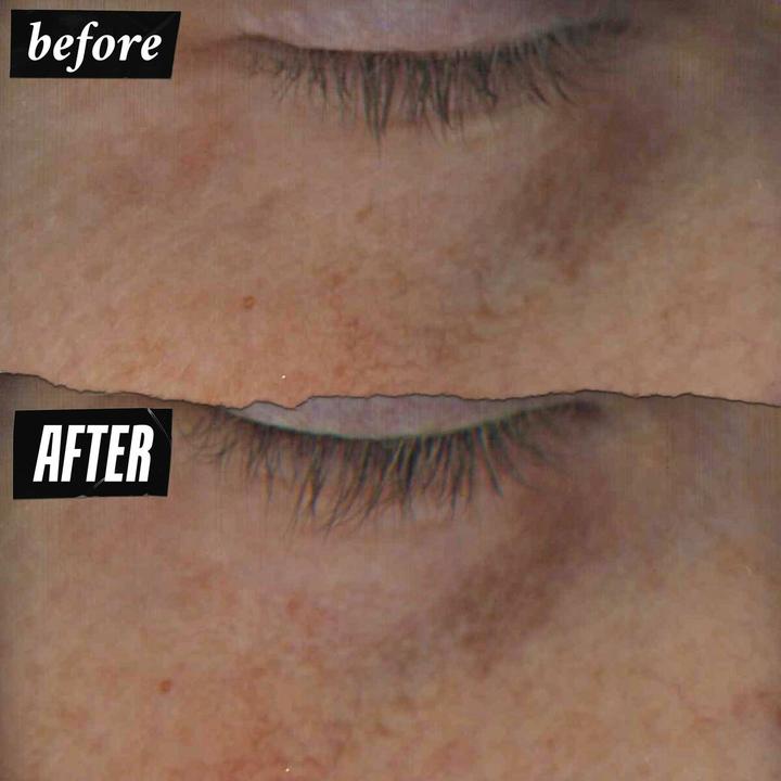 Produktbild Kiehl's Dermatologist Solutions Powerful-Strength (Augenpflege Serum, 15 ml)