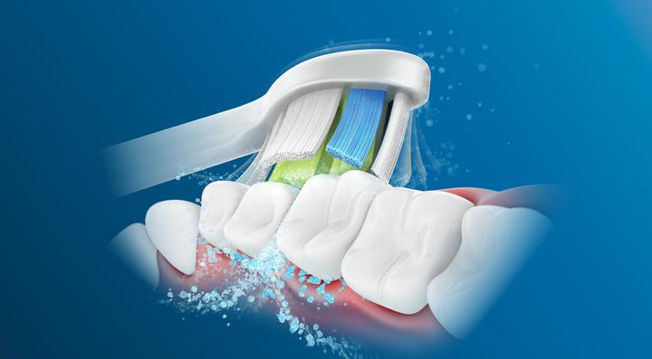 Actual product image Philips Sonicare W2 Optimal White (8 x)
