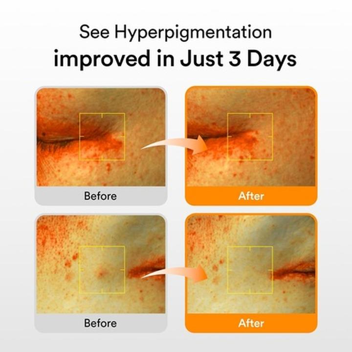 Immagine prodotto Abib Glutathiosome Dark Spot Serum Vita Drop (50 ml)