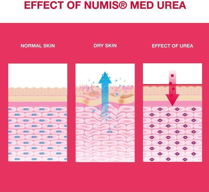Produktbild Numis Med UREA 5% Shampoo (200 ml, Flüssiges Shampoo)