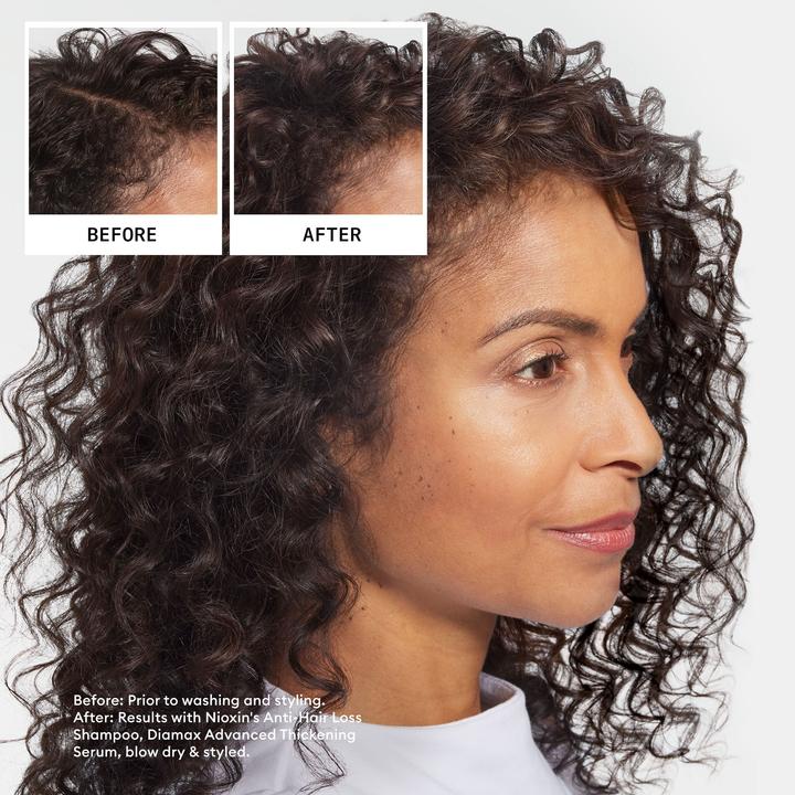 Produktbild Nioxin Anti-Hair Loss (Flüssiges Shampoo, 240 ml)