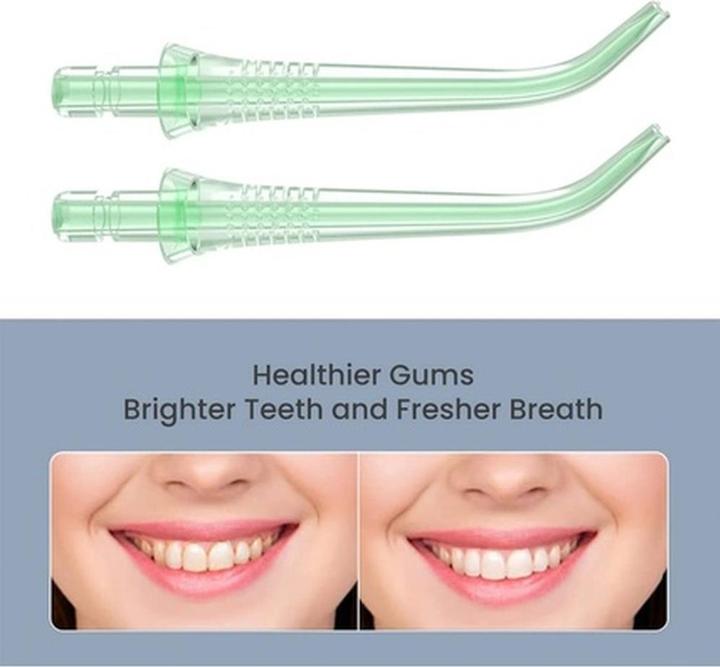 Actual product image Oclean N10-W10 (Oral irrigator attachments)