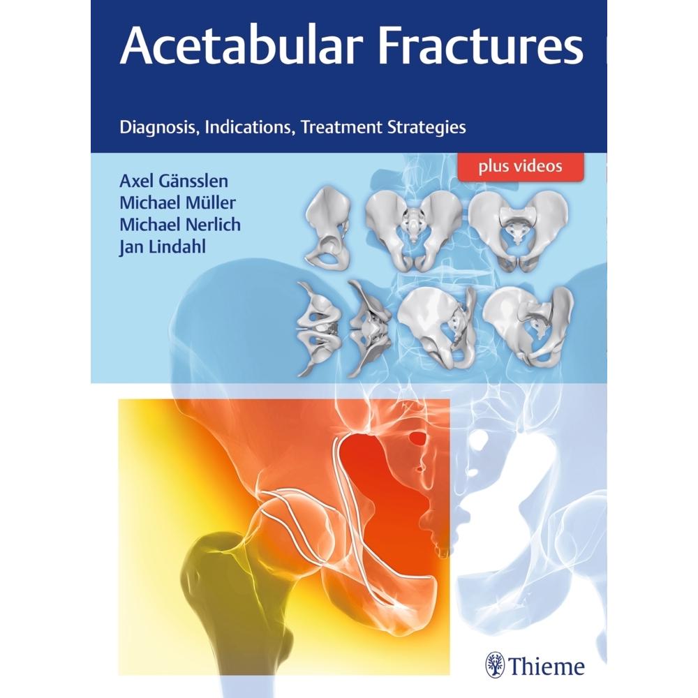Thieme, Stuttgart, Bandage, Gänsslen, Acetabular Fractures