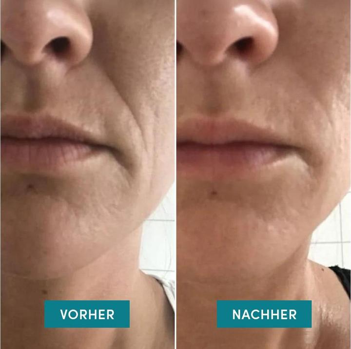 Immagine prodotto Apricot - Wiederverw. Mund Pad Mit Hyaluron I Love Your Smile - 2 Stk.