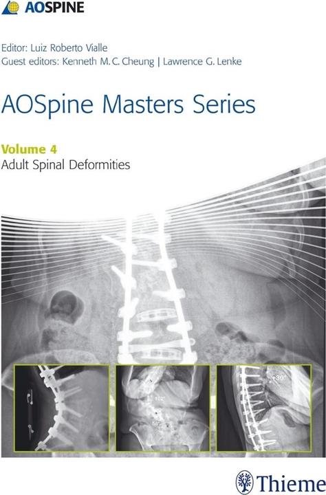 AOSpine Master Series - Adult Spinal De (Englisch, Luiz Roberto Gomes Vialle, Lawrence G. Lenke, Kenneth M.C. Cheung, 2015)